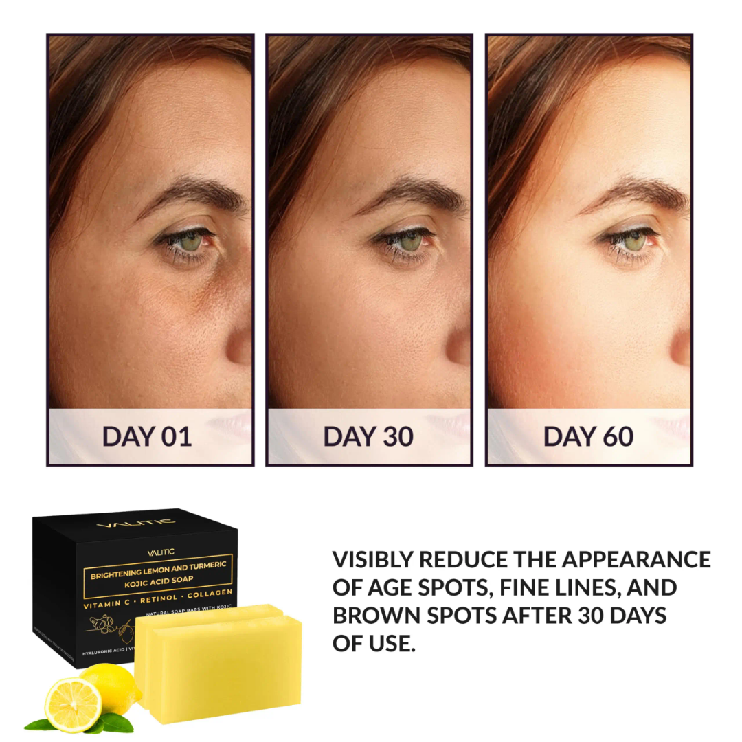 1 pcs Kojic Acid Soap, Glutathione & Ginger Essential Oil Handmade Soap, Turmeric Soap