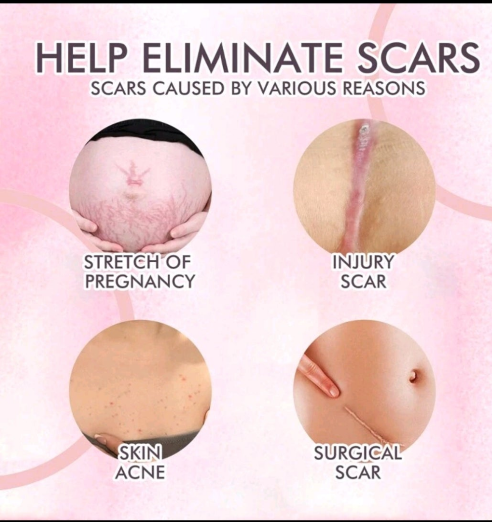 Skincare Body Oil, Fade Scars, Pregnancy Fine Lines
Moisturize And Repair Delicate And Smooth Body Skin