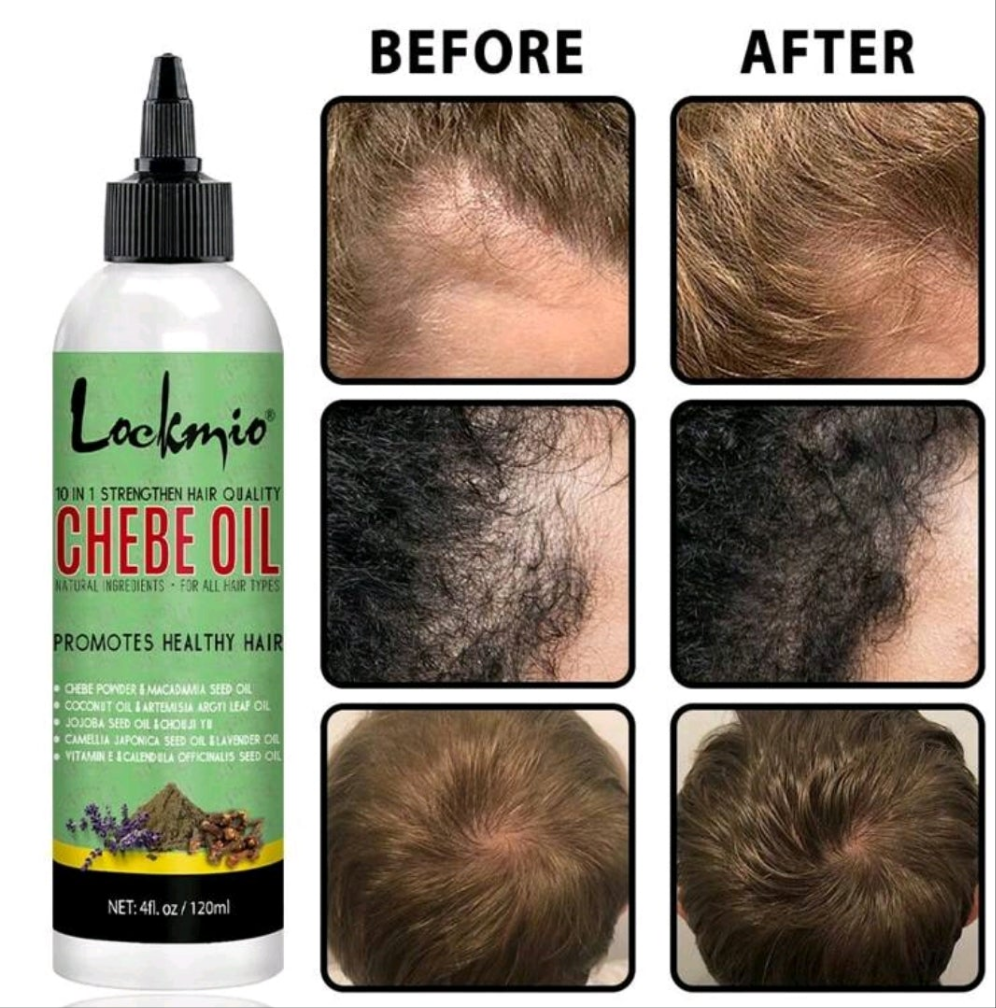 Natural  Hair Oil Infused With 10 In 1   Powder, Scalp Hair Care Moisturizing Product For Damaged Dry Hair, Strengthens Hair Essential Oil