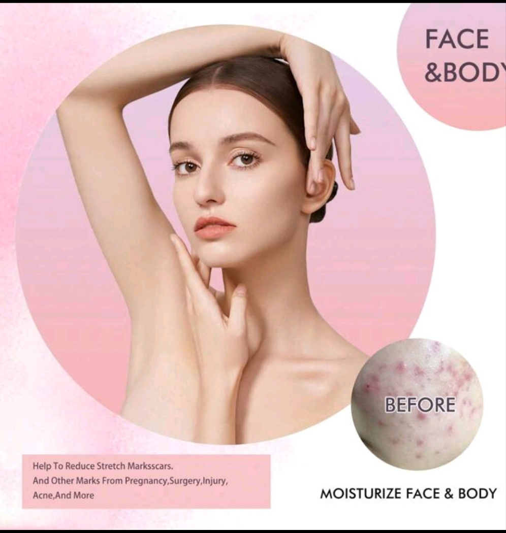 Skincare Body Oil, Fade Scars, Pregnancy Fine Lines
Moisturize And Repair Delicate And Smooth Body Skin