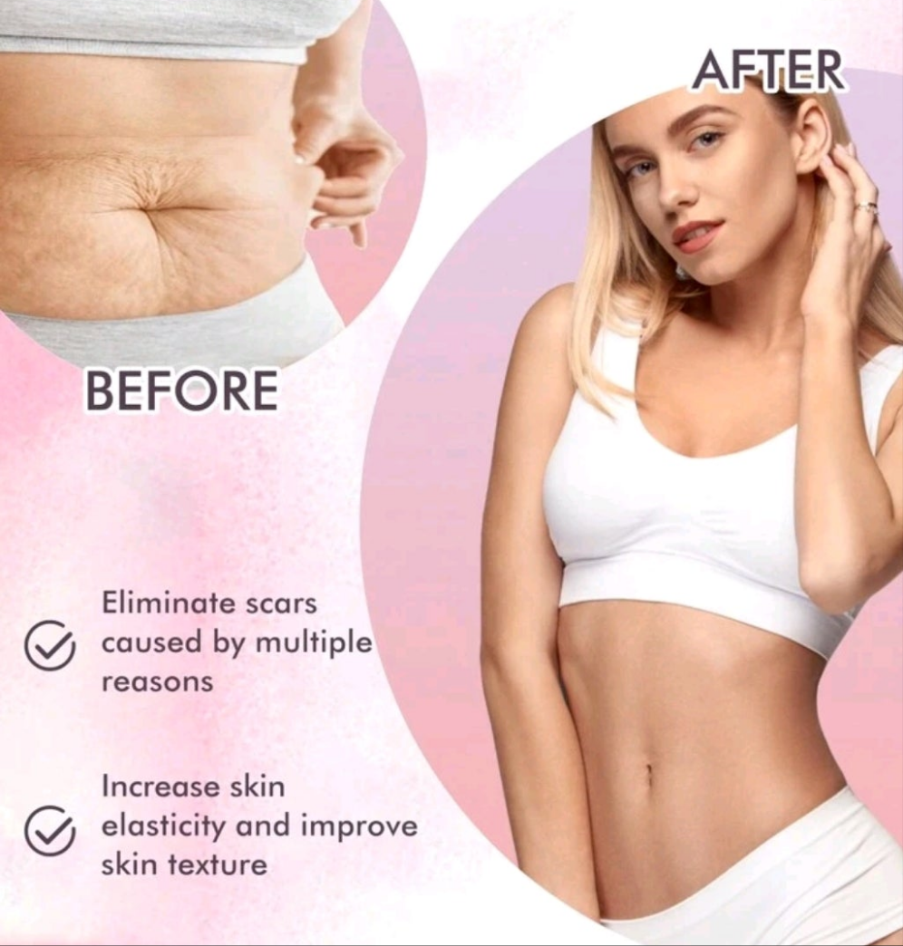 Skincare Body Oil, Fade Scars, Pregnancy Fine Lines
Moisturize And Repair Delicate And Smooth Body Skin