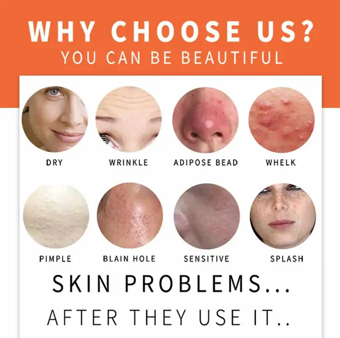 1 pcs Handmade Kojic Acid Soap for Oily Turmeric Papaya
Orange Essential Oils Solid Bar Soap Brightens Made Shea
Butter for Adults